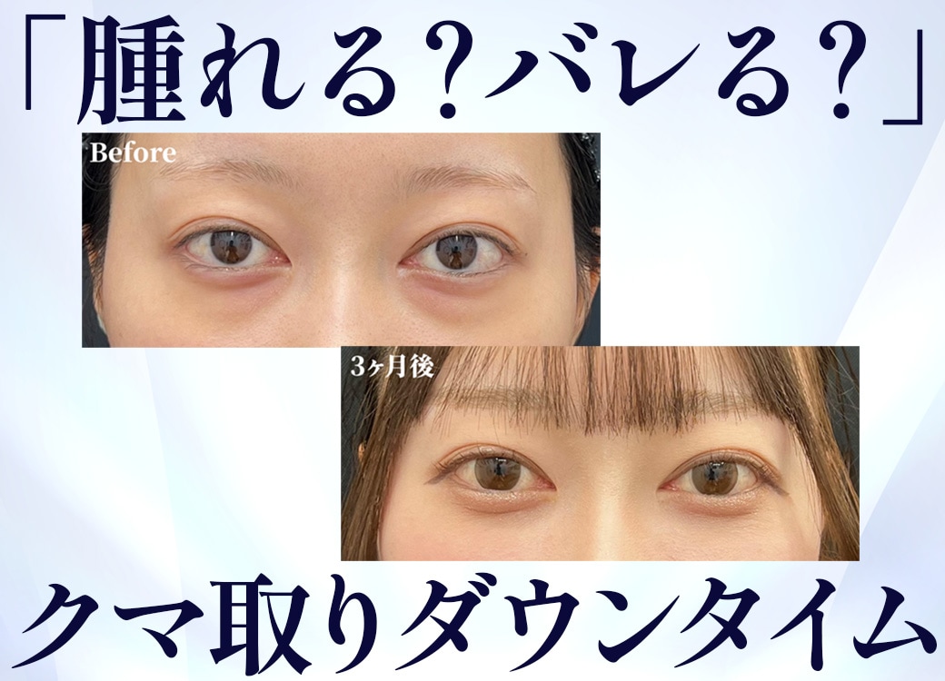 満を持して。脱・老け顔の最短ルート!! 野水先生の目の下のクマ取り