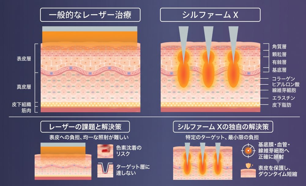 シルファームXとは