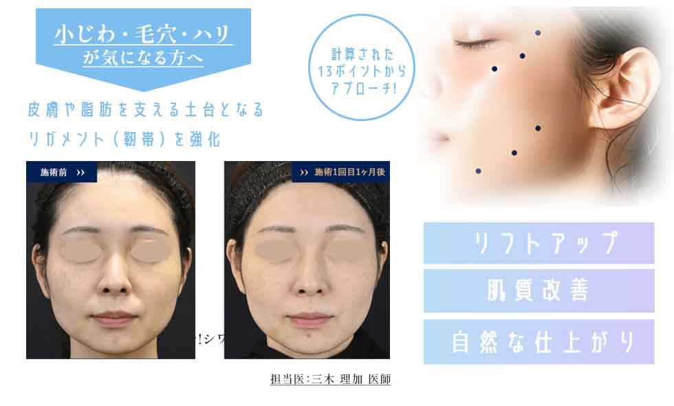 ジャルプロスーパーハイドロ