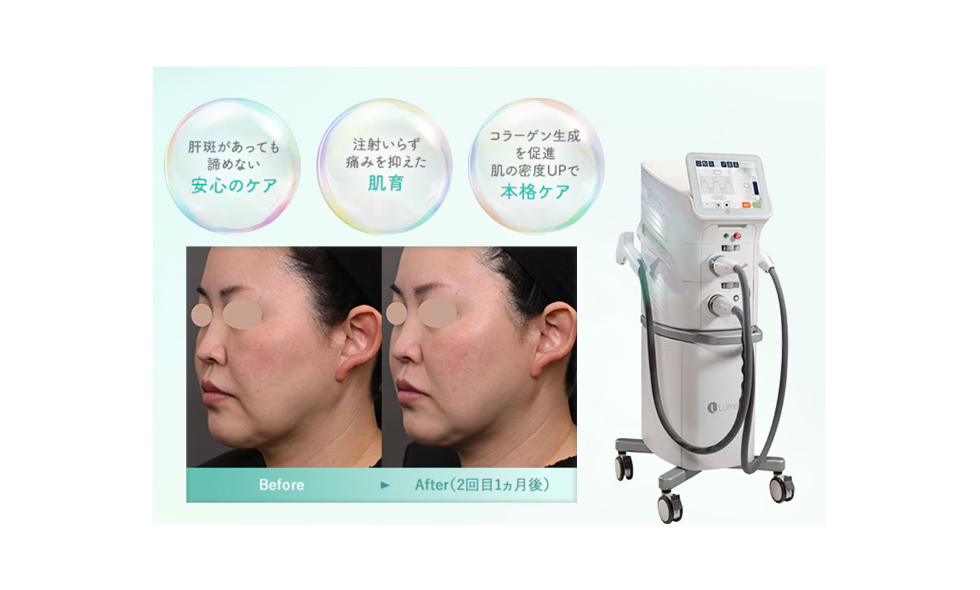 「ファーストステップ」にフォトジェネシス