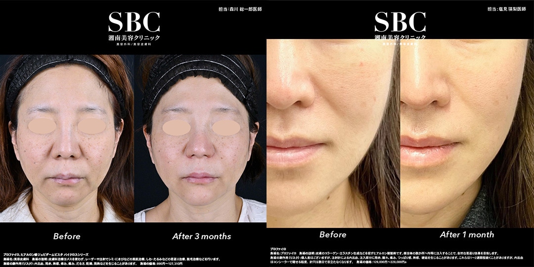 どの部位が効果的？