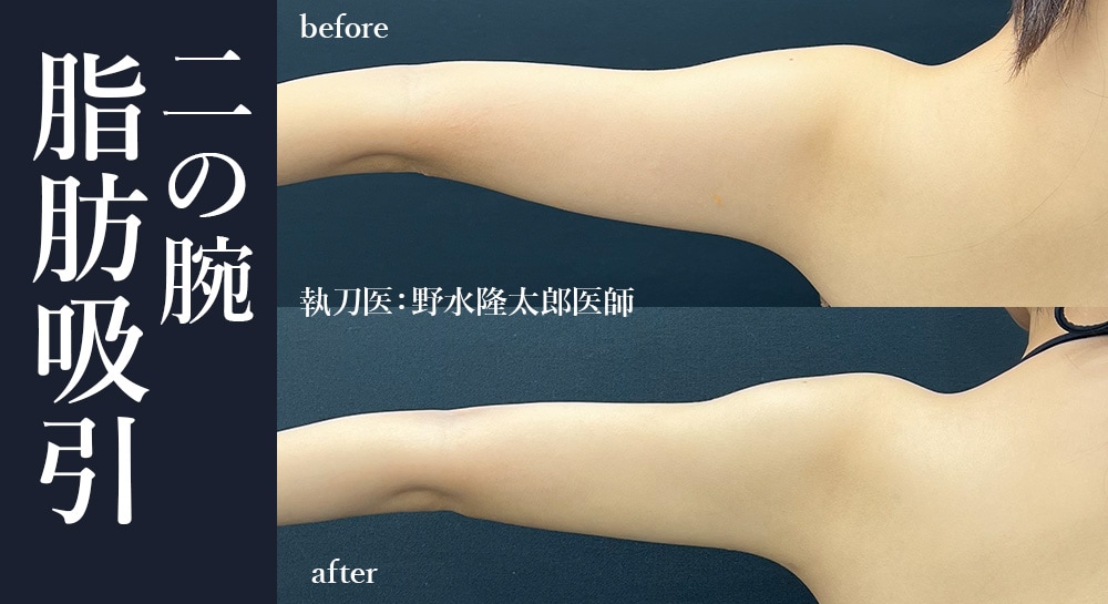 野水院長が叶える「“生まれつき細い”と錯覚させる、凹凸ゼロのシルエット」