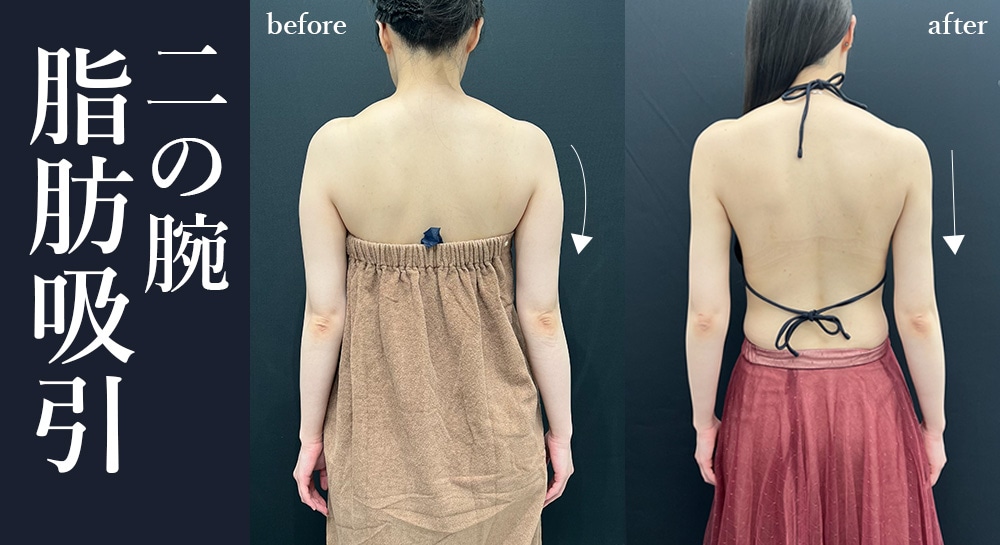 バレないための最重要ポイントは「執刀医選び」