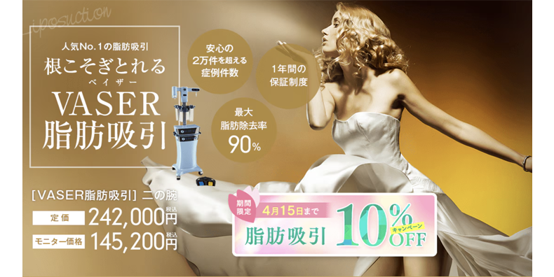 ベイザー脂肪吸引