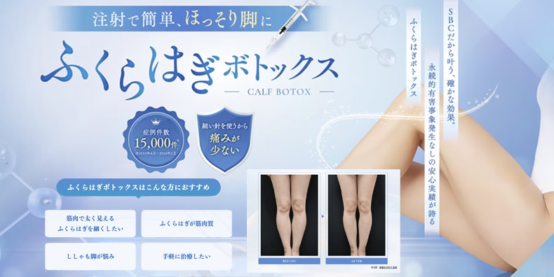 ふくらはぎボトックス_キャンペーン