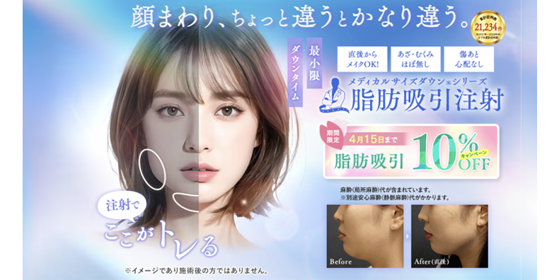 脂肪吸引注射<br />
