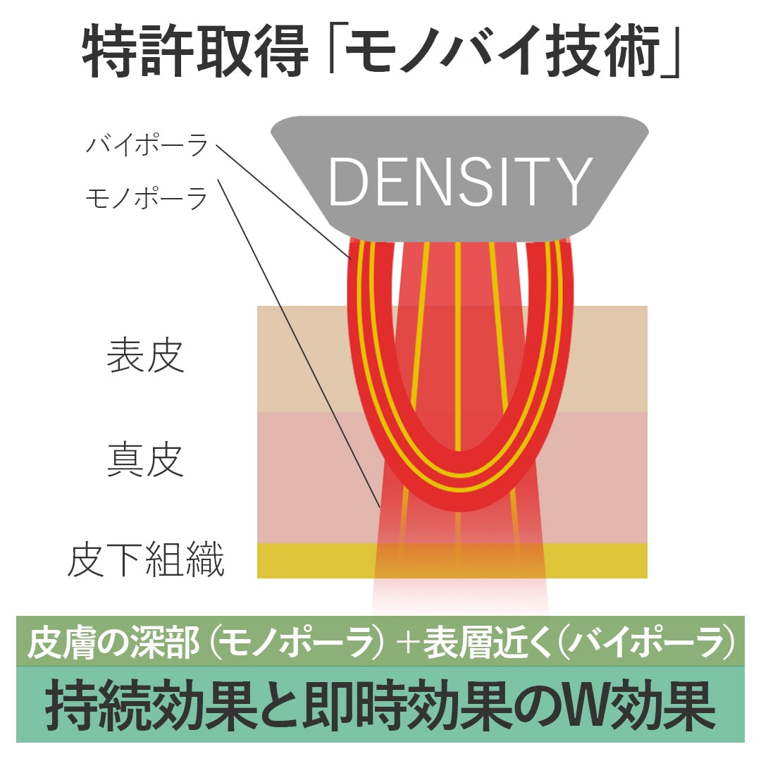 モノポーラRFとバイポーラRFとは？<br />
