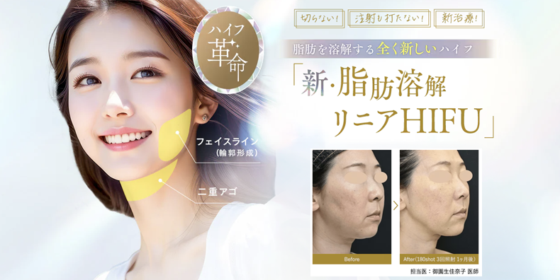 リニアハイフ_キャンペーン