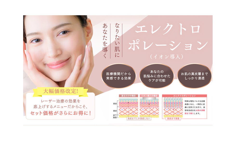イオン導入_自由が丘