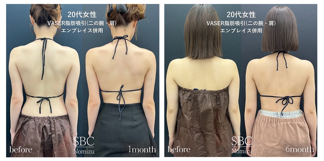 ダイエットとの決定的な違い