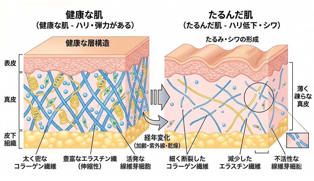 ② 皮下脂肪の増減・下垂によるたるみと対応治療