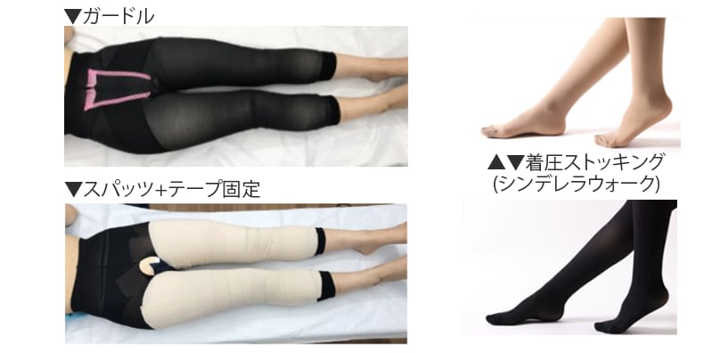 【膝・大腿・臀部】術後の圧迫