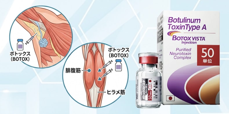 医師が解説する「わき・ふくらはぎボトックス」の基礎知識
