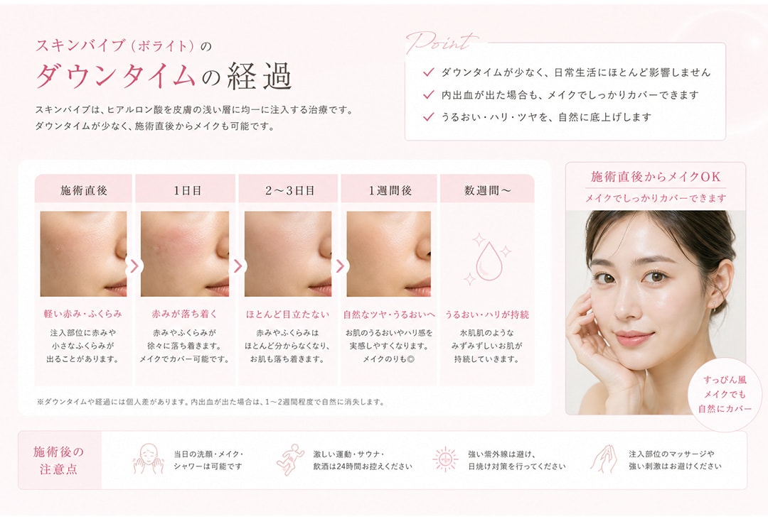 注射後の腫れや内出血はいつから引く？期間の目安