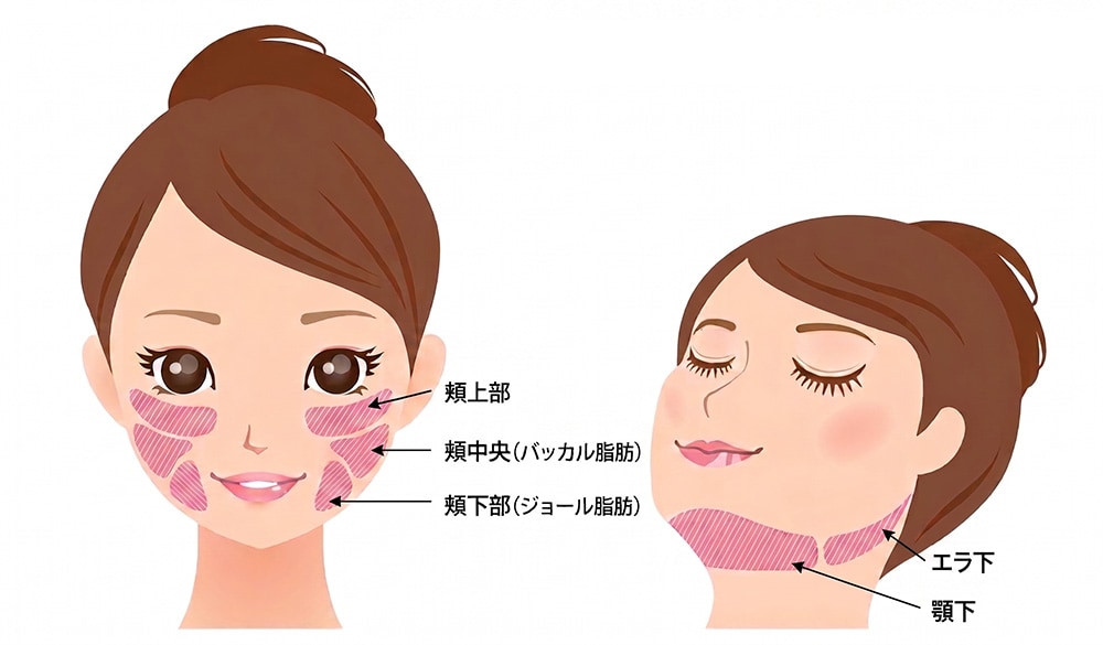 脂肪吸引注射がおすすめな人の特徴