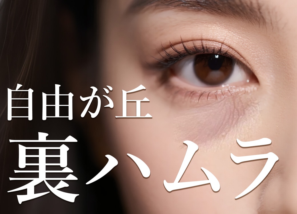 【野水医師解説】自由が丘の裏ハムラ法!切らないクマ取りとの違い|目黒区・世田谷