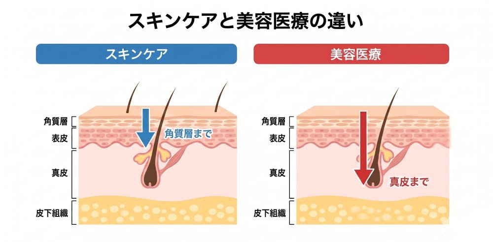 スキンケアでは真皮層に届かない