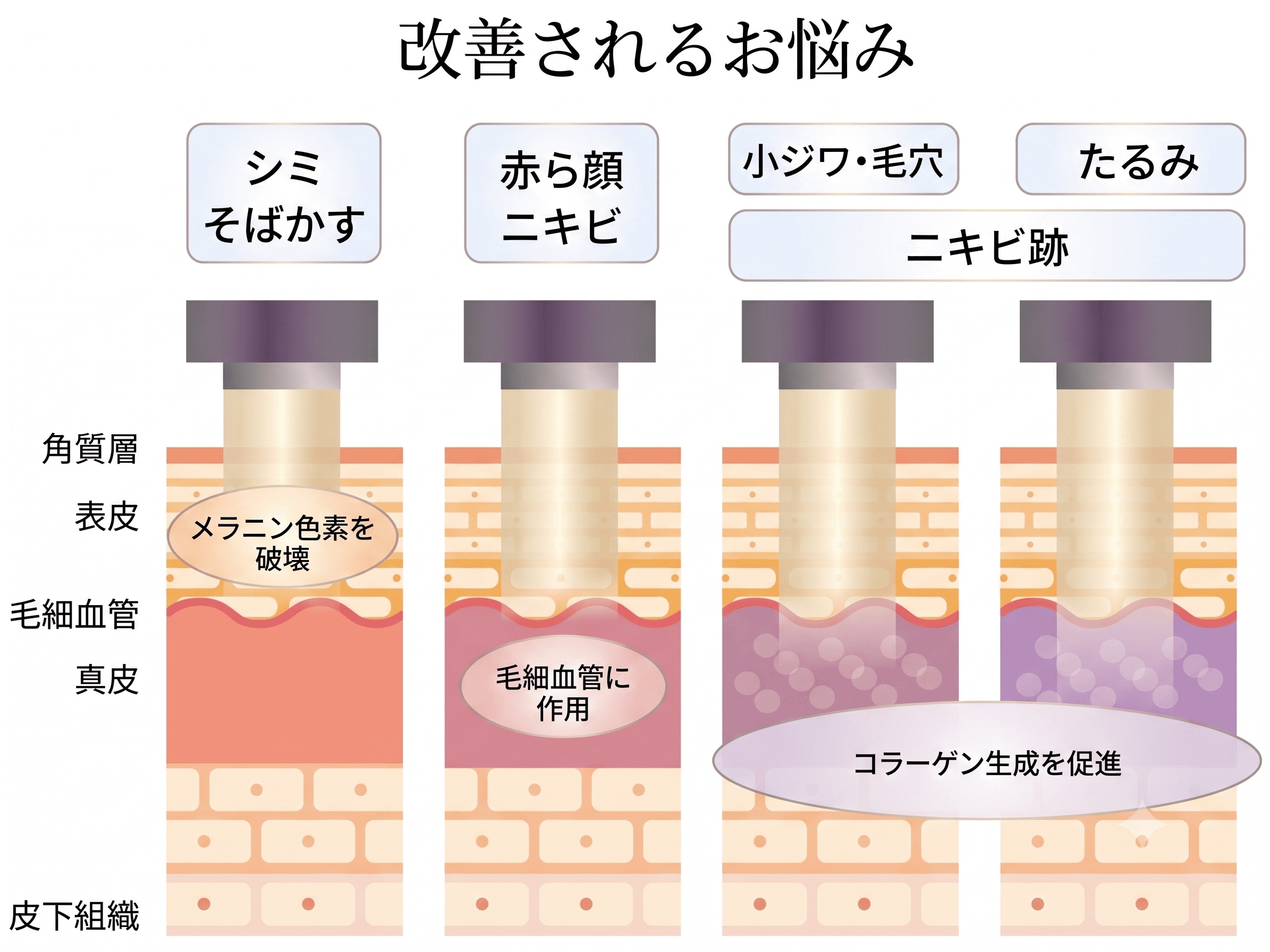シミ・くすみ・赤ら顔など「複数の肌悩み」を同時にケア