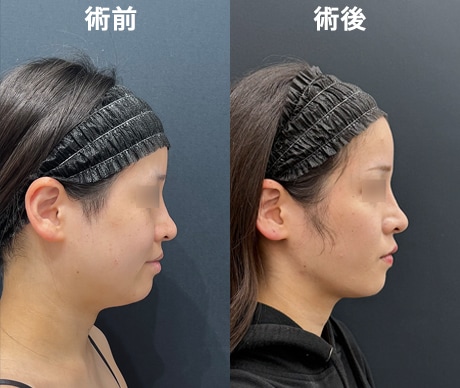 https://www.s-b-c.net/clinic/branch/jiyugaoka/wp-content/uploads/sites/43/2026/07/野水医師症例.jpg