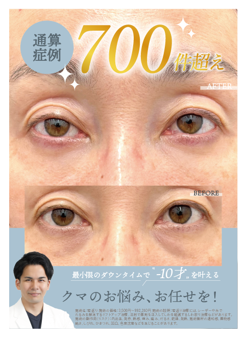 クマ取りするなら照屋指名にお任せ！