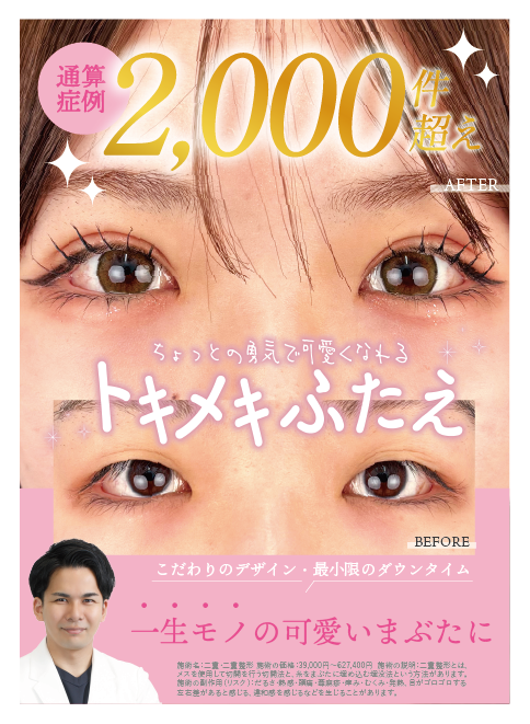 春休み🌸二重のかけ込み予約受付中！