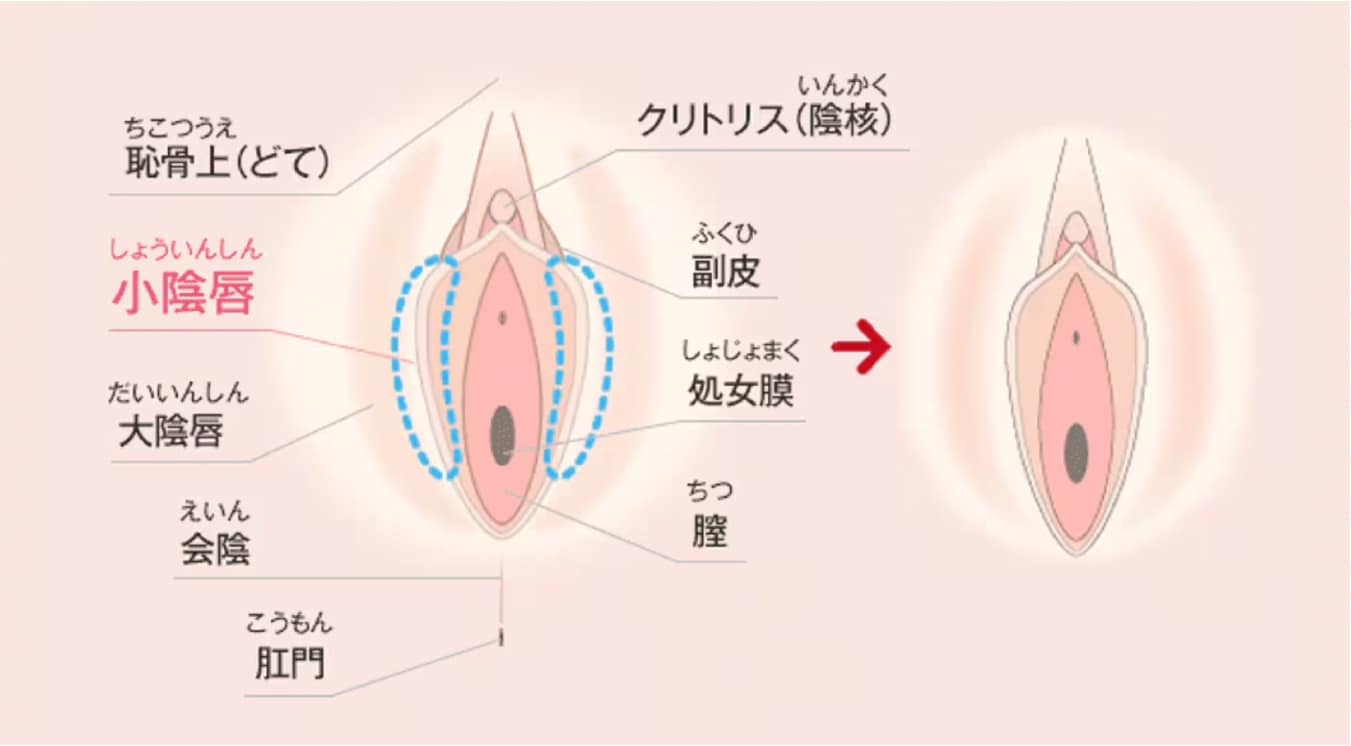 处女膜 