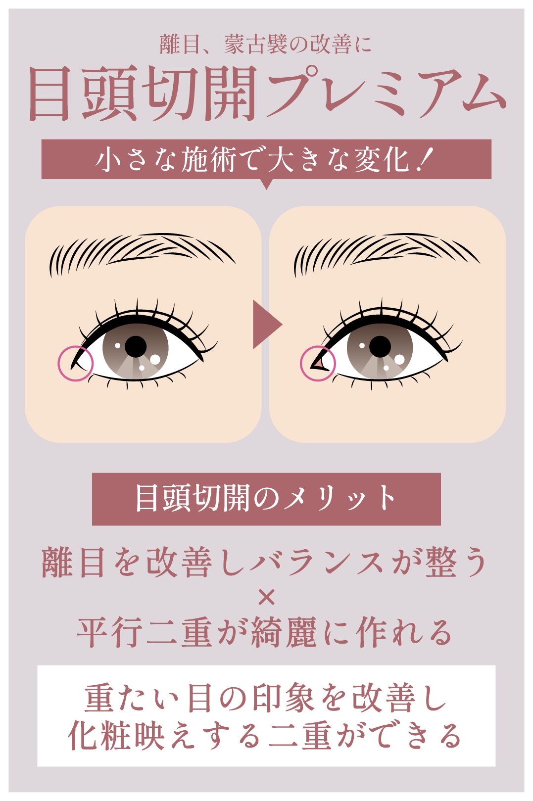 目頭切開プレミアム