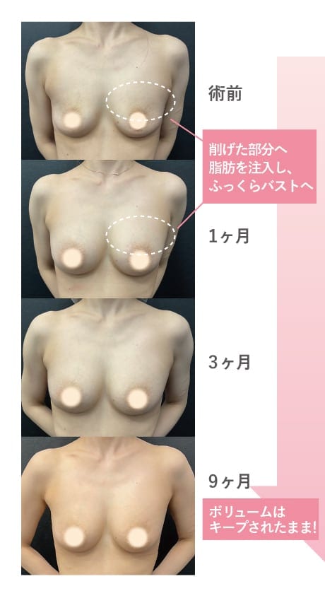 ちゃんと定着するの?