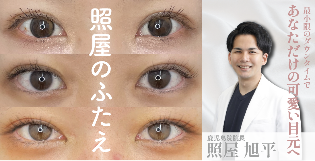 point.1  デザインにこだわりたい
