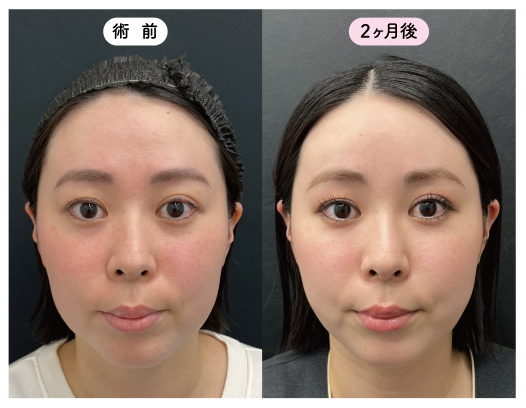 \ナチュラルかつ綺麗な理想的な若返り方/