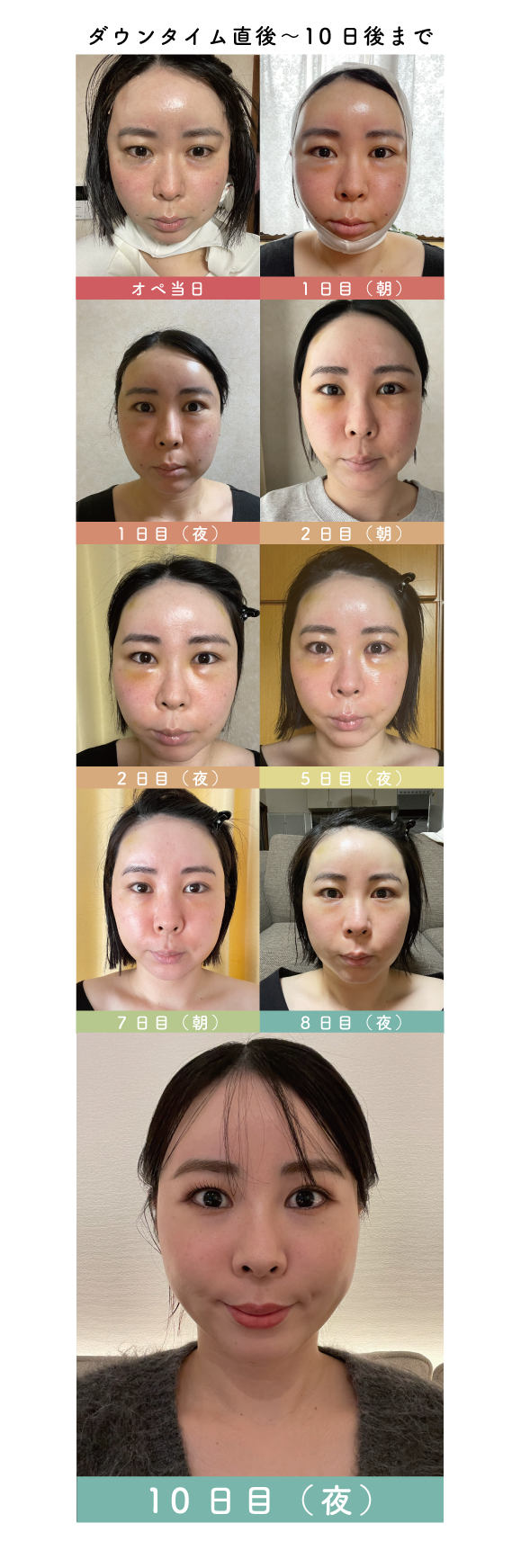 \術後〜10日後までのダウンタイム/