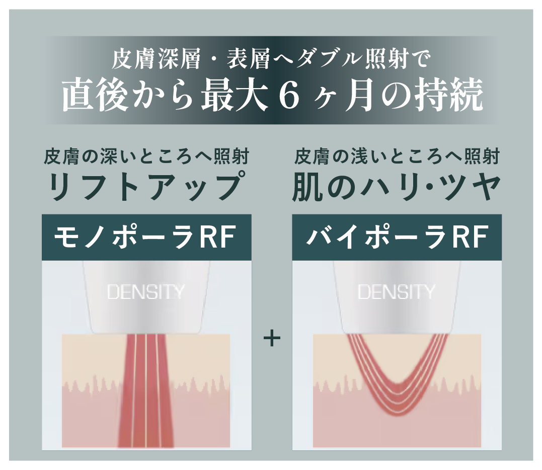 ２種類の照射で隙のないたるみケア