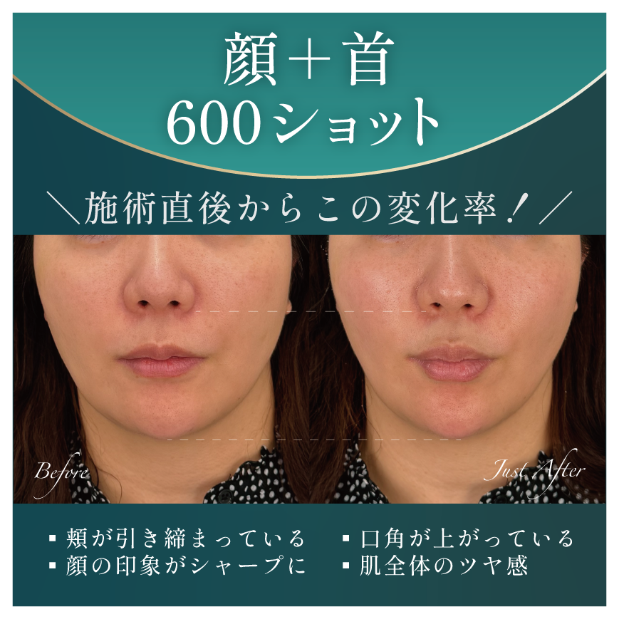 顔＋首 600ショット