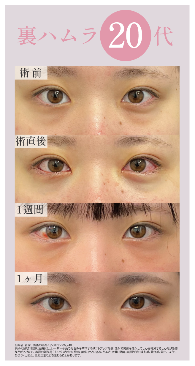 20代　女性