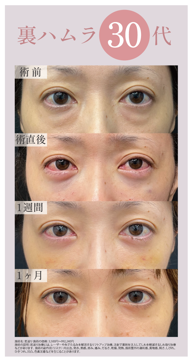 30代　女性