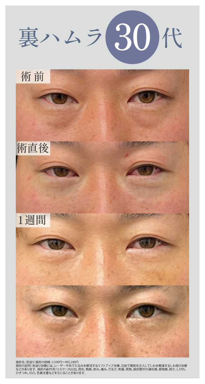 30代　男性