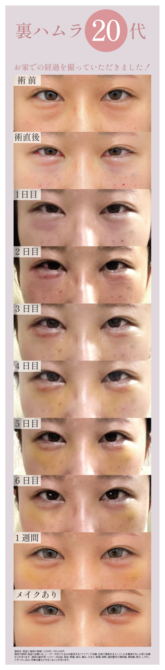 20代　女性