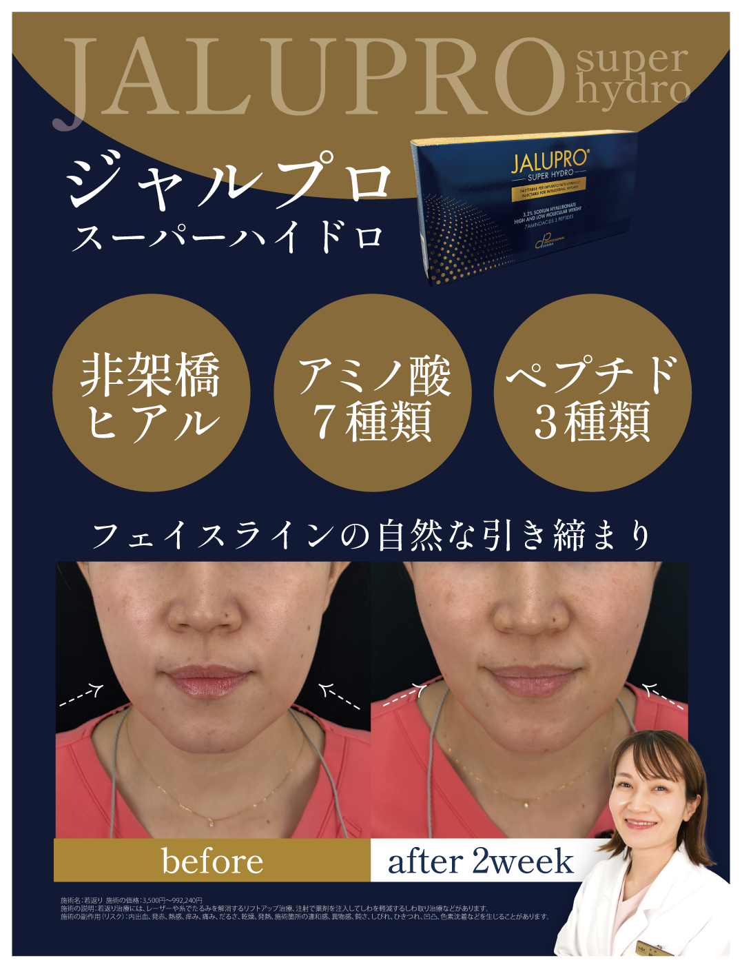 ジャルプロスーパーハイドロ