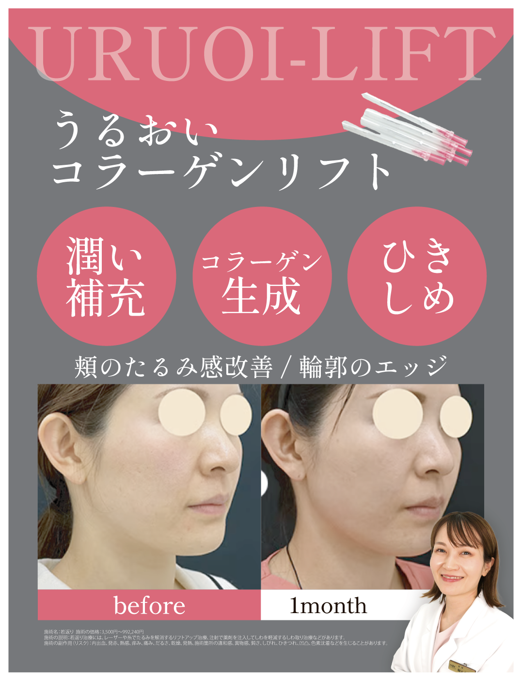 うるおいコラーゲンリフト