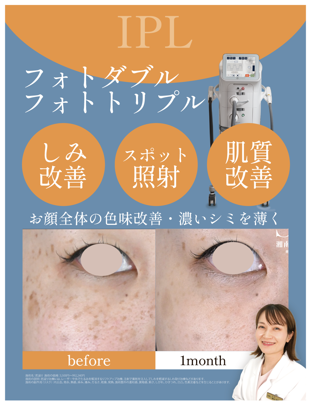 フォトダブル・トリプル