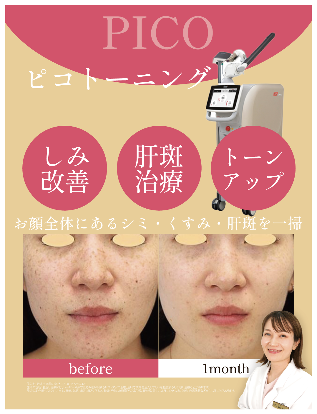 ピコトーニング