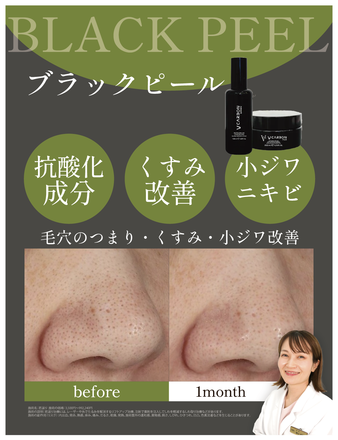 ブラックピール