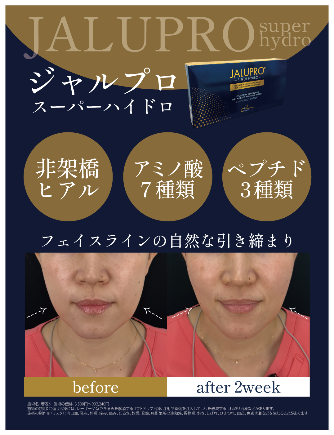 ジャルプロスーパーハイドロ