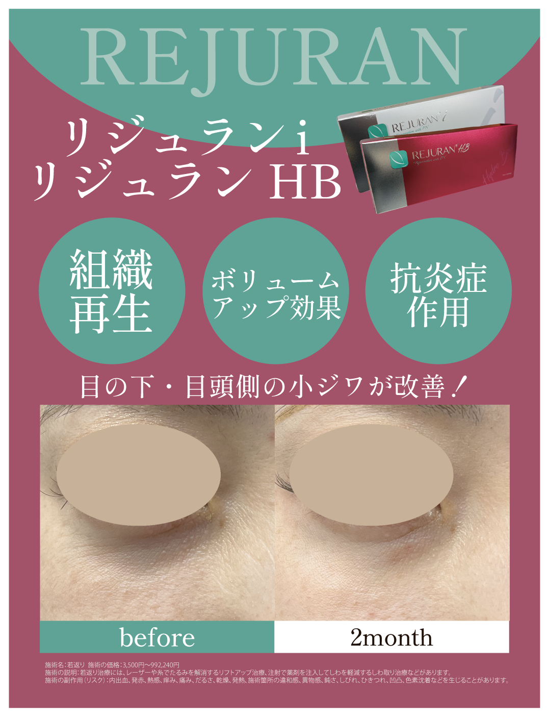 ＼目の下の小ジワにはやっぱりこれ！／