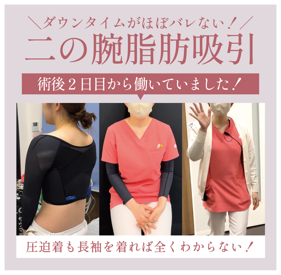 実は顔よりも人気の”二の腕”