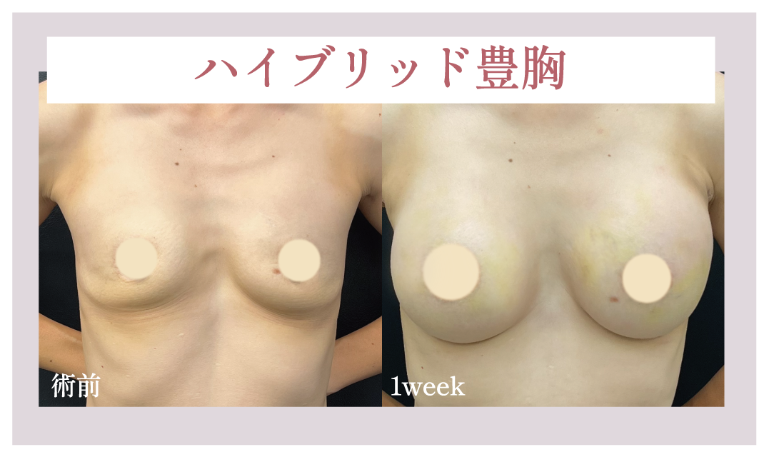 バランス重視の場合☝️