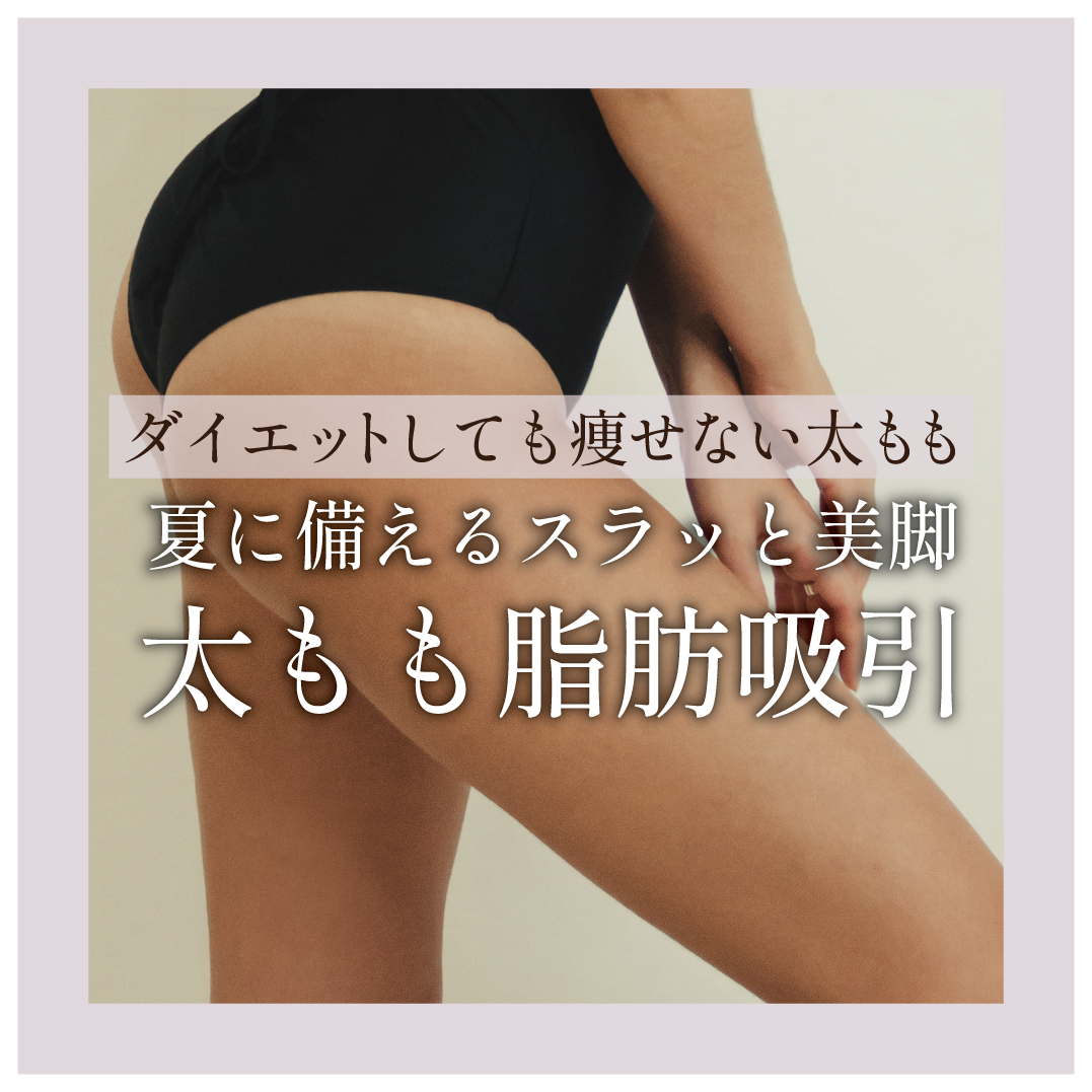 夏に備える💪痩せにくい太ももは脂肪吸引でスラッと美脚に！
