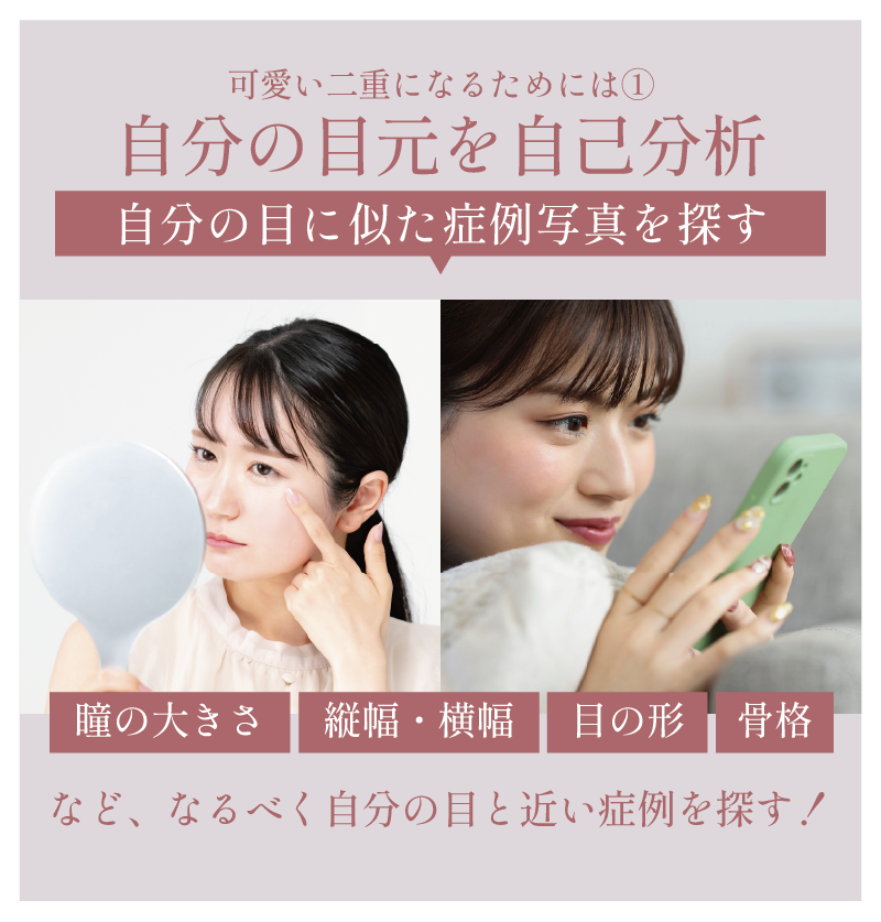 自分の目に似た症例写真を探す！