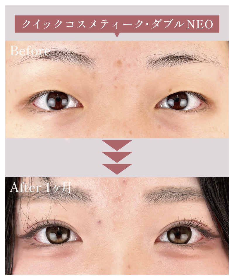 【並行型】クイックコスメティーク・ダブルNEO