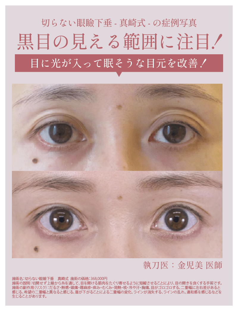 黒目の見える範囲に注目！